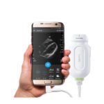 Sistema de Ultrasonido Portátil PHILIPS Lumify
