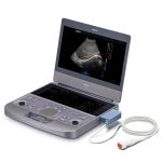 Ecografo Portatil EDAN Acclarix AX8