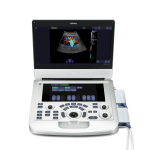 Ecografo Portatil EDAN Acclarix AX3